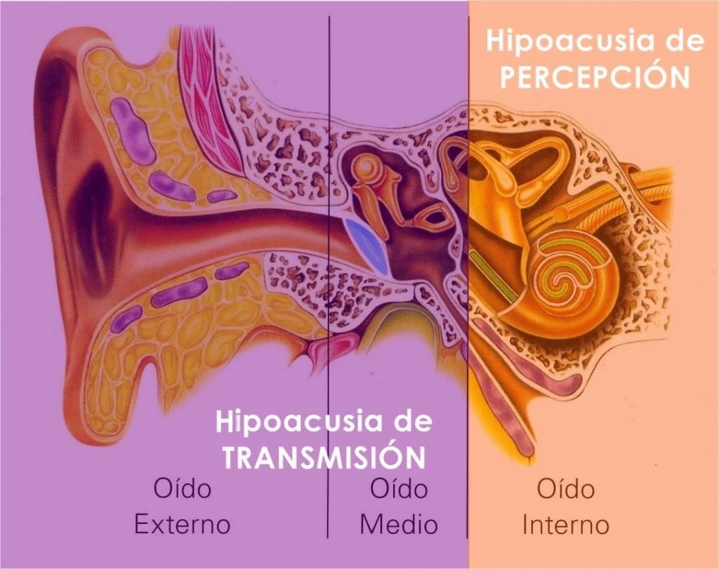 imagenes de discapacidad auditiva